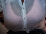 Hgh Help Breast Growth For Mtf 52